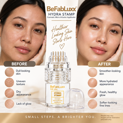 Serum Applicator Cosmetic Hydra Needle Derma Stamp 0.25mm 24K Gold Plated Microneedling Roller Stamp (Serum is Not Included)